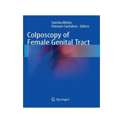 预订 Colposcopy of Female Genital Tract