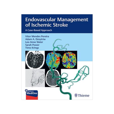 [预订]Endovascular Management of Ischemic Stroke 9781626232754