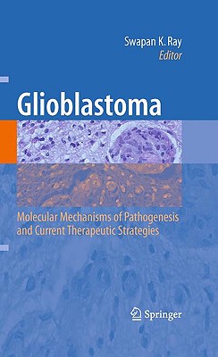 【预订】Glioblastoma: