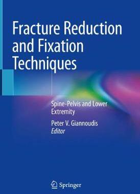【预订】Fracture Reduction and Fixation Techniques