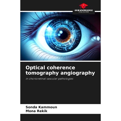 预订 Optical coherence tomography angiography 光學相干斷層血管造影術: 9786208276058
