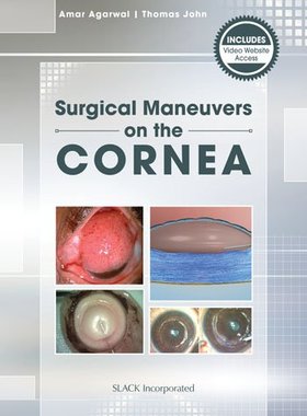 【预售】Mastering Corneal Surgery