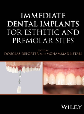 预订 Immediate Dental Implants for Esthetic and Premolar Sites 用于美观部位和磨牙部位的即刻种植牙: 9781394187102