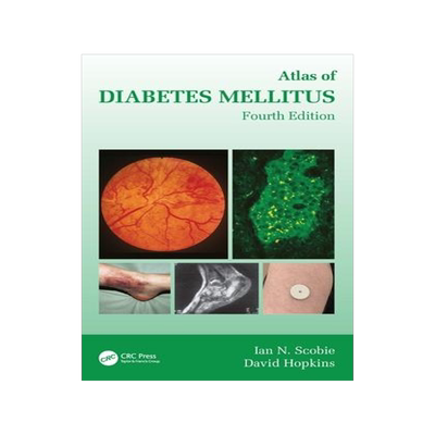 [预订]Atlas of Diabetes Mellitus 9781032379456