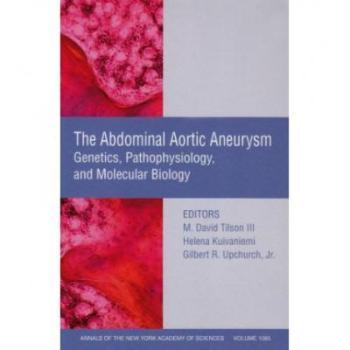 【预订】Abdominal Aortic Aneurysm