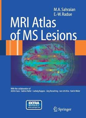 【预订】MRI Atlas of MS Lesions