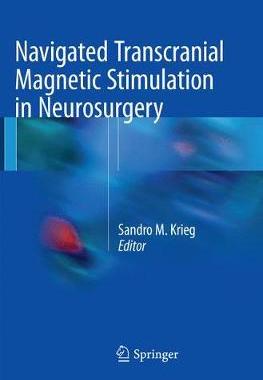 预订 Navigated Transcranial Magnetic Stimulation in Neurosurgery