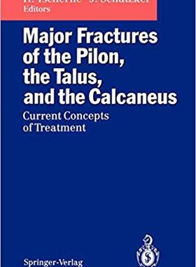 【预订】Major Fractures of the Pilon, the Talus, and the Calcaneus