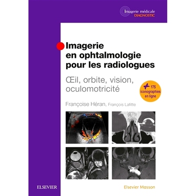 预订 Imagerie en ophtalmologie pour les radiologues 放射科医生的眼科成像: 9782294754463