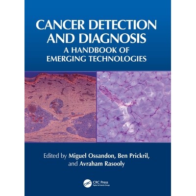 预订 Cancer Detection and Diagnosis A Handbook of Emerging Technologies 癌症检测与诊断:新兴技术手册 9781032577012