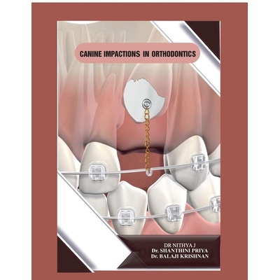 预订 Canine Impactions in Orthodontics 9798901768266