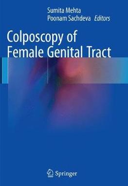 预订 Colposcopy of Female Genital Tract