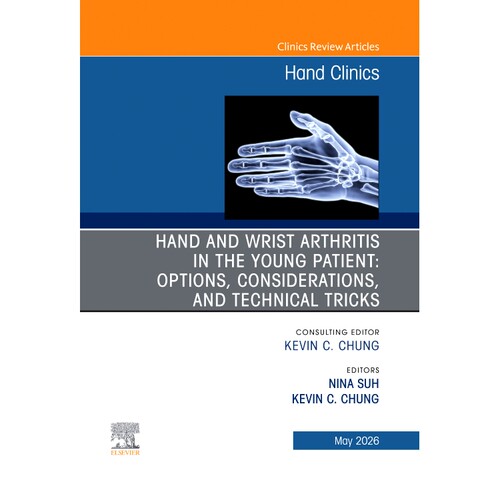Options, Considerations, and Technical T