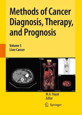 【预订】Methods of Cancer Diagnosis, Therapy, and Prognosis