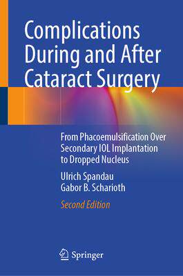 [预订]Complications During and After Cataract Surgery 9783030935306
