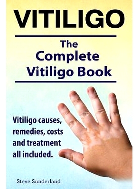 预订 Vitiligo. Vitiligo causes, remedies, costs and treatment all included. The complete Vitiligo Book.: 9781910410844