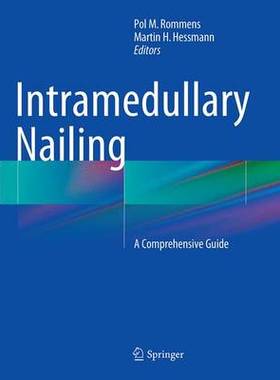 预订 Intramedullary Nailing