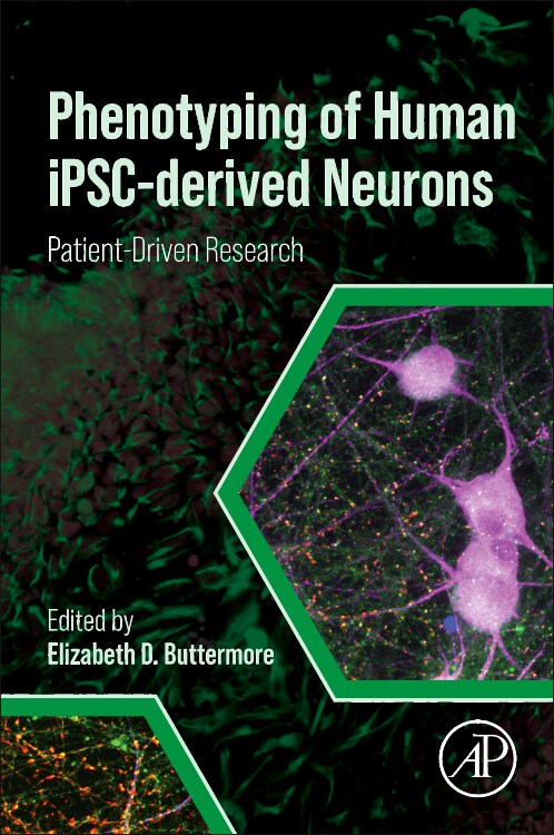 [预订]Phenotyping of Human Ipsc-Derived Neurons