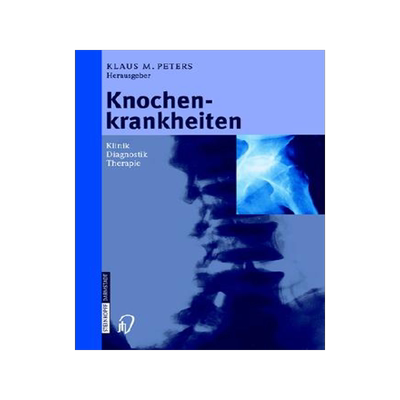预订 Knochenkrankheiten: Klinik Diagnose Therapie
