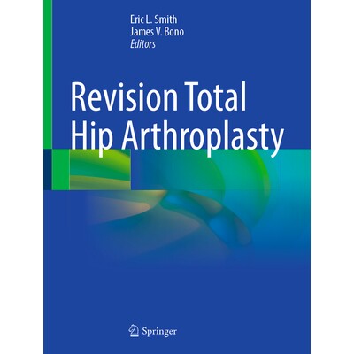 预订 Revision Total Hip Arthroplasty 翻修全髋关节置换术 9783031839580