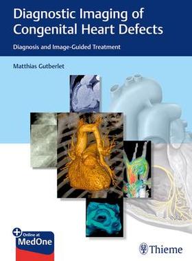 [预订]Diagnostic Imaging of Congenital Heart Defects 9783132402515