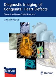 Imaging Congenital Defects Diagnostic Heart 9783132402515 预订