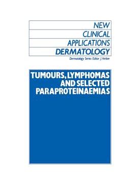 【预订】Tumours, Lymphomas and Selected Paraproteinaemias