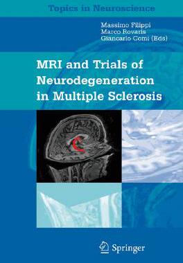 【预订】Neurodegeneration in Multiple Sclerosis
