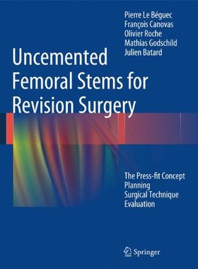 【预订】Uncemented Femoral Stems for Revision Surgery