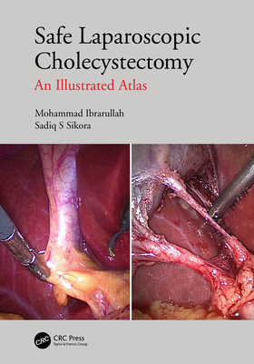 【预订】Safe Laparoscopic Cholecystectomy 9781032005218
