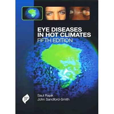 预订 Eye Diseases in Hot Climates: 9781909836228