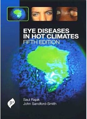 预订 Eye Diseases in Hot Climates: 9781909836228