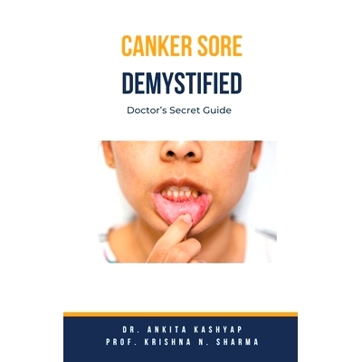预订 Canker Sore Demystified: Doctor's Secret Guide