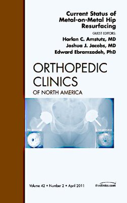 【预订】Current Status of Metal-on-Metal Hip Resurfacing, An Issue of Orthopedic Clinics