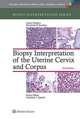 【预订】Biopsy Interpretation of the Uterine Cervix and Corpus