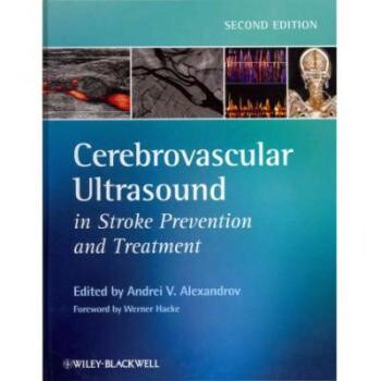 预订 Cerebrovascular Ultrasound in Stroke Prevention and Treatment 2E 中风预防与治疗中的脑血管超声 第2版: 9781405195768