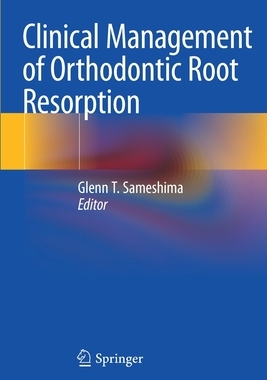 【预订】Clinical Management of Orthodontic Root Resorption 9783030587086