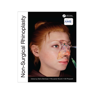 [预订]Non-Surgical Rhinoplasty