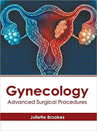 【预售】Gynecology: Advanced Surgical Procedures