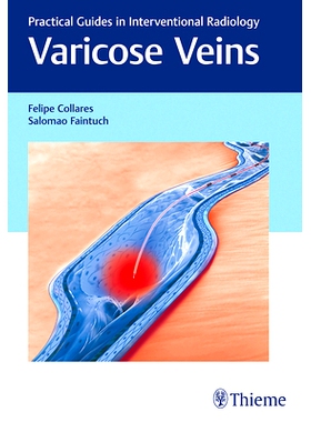 预订 Varicose Veins: Practical Guides in Interventional Radiology 静脉曲张：门诊药系列: 9781626230125