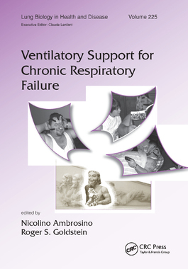 【预订】Ventilatory Support for Chronic Respiratory Failure