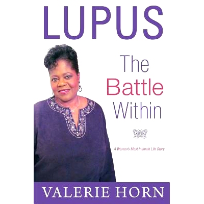 预订 Lupus: The Battle Within: A Woman’s Most Intimate Life Story: 9780692692806