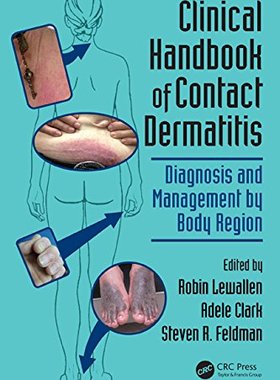 【预订】Clinical Handbook of Contact Dermatitis