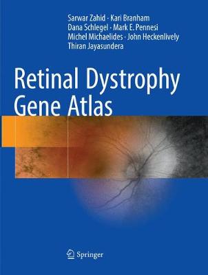 预订 Retinal Dystrophy Gene Atlas