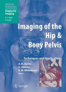 the Hip Pelvis 预订 Bony Imaging