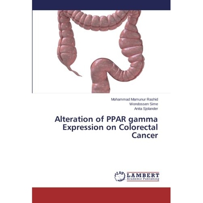 预订 Alteration of Ppar Gamma Expression on Colorectal Cancer: 9783659246647