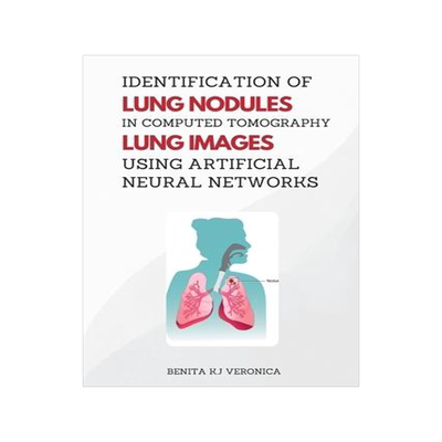 [预订]Identification of Lung Nodules in Computed Tomography Lung Images Using Artificial Neural Networks 9787692280965