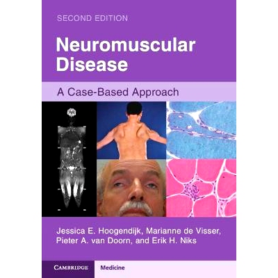 预订 Neuromuscular Disease: A Case-Based Approach 神经肌肉疾病：基于案例的方法: 9781108744188