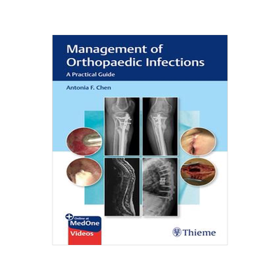 [预订]Management of Orthopaedic Infections: A Practical Guide 9781684201334
