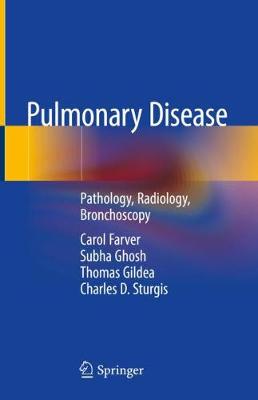 【预订】Pulmonary Disease